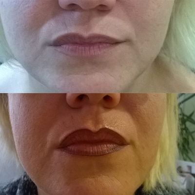 Lippen 1