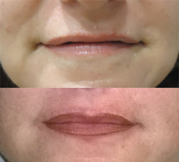 Lippen 2
